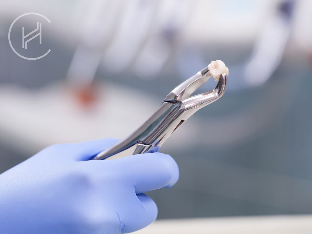 tooth extraction in turkey