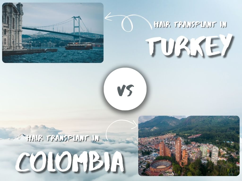 Hair Transplant Colombia vs Turkey comparison banner