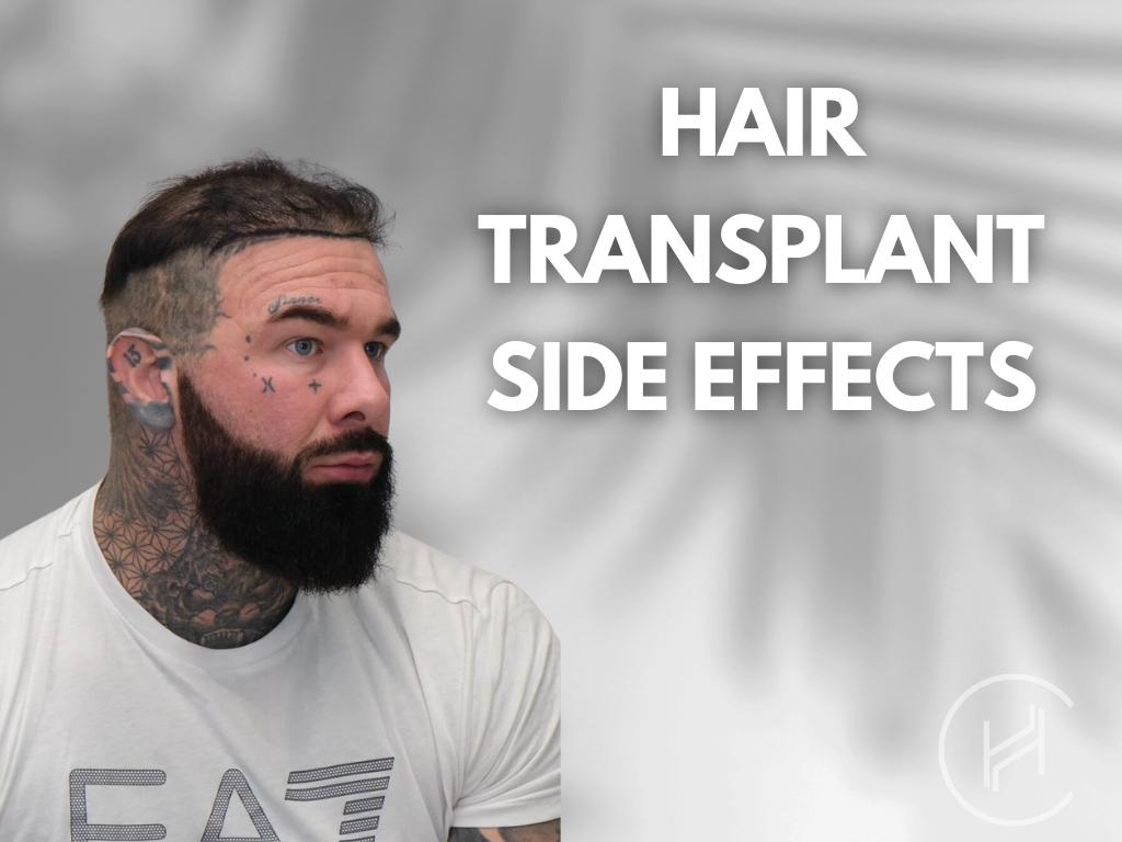 Hair transplant side effects banner Hair transplant side effects banner