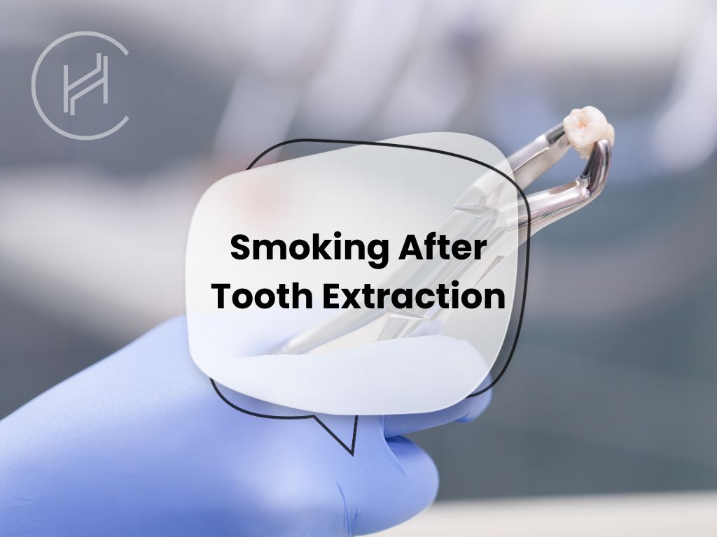 Smoking After Tooth Extraction Banner
