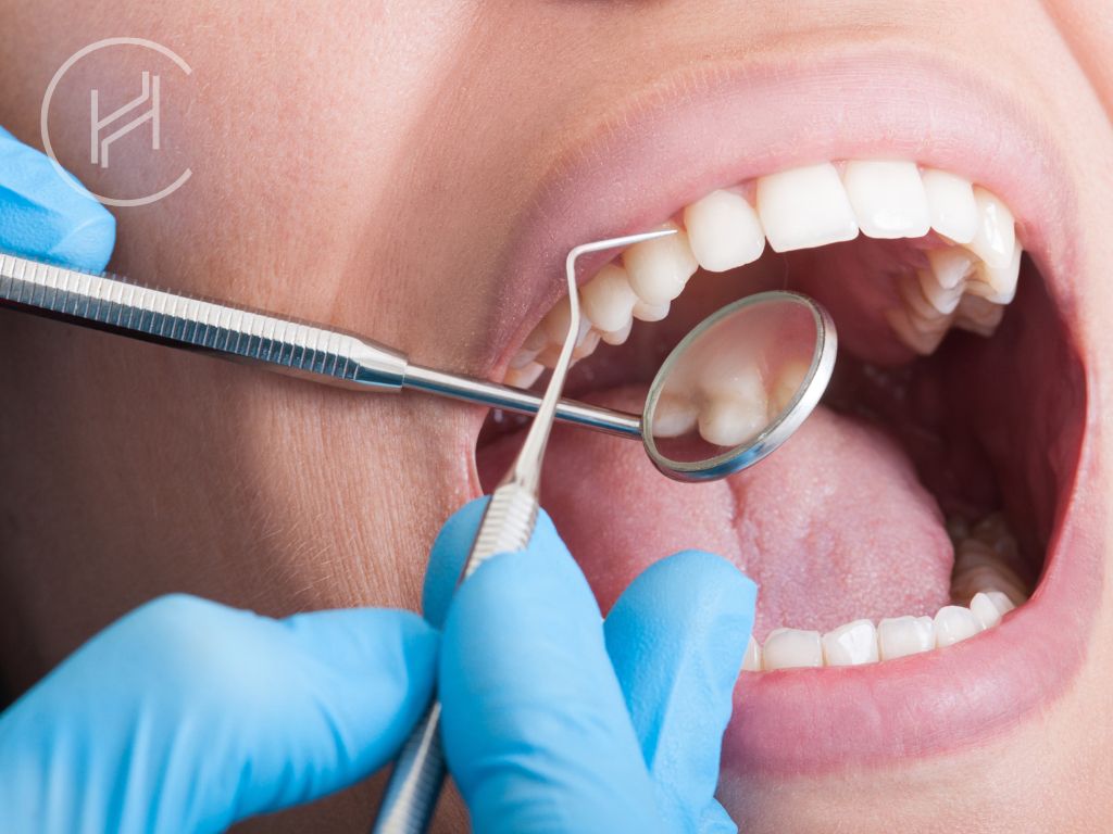 Teeth filling consultation in turkey Teeth filling consultation in turkey