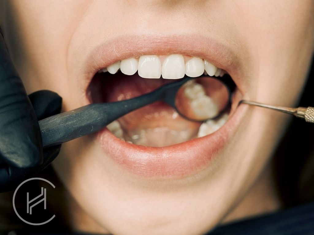 Teeth filling turkey female patient