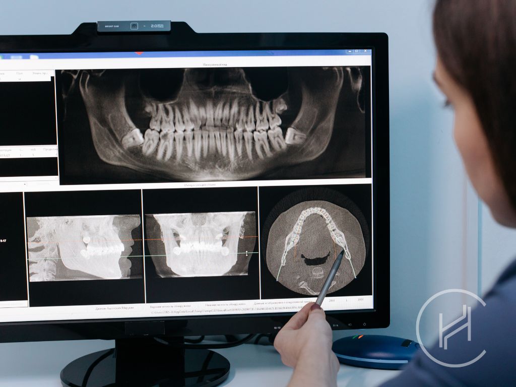 Tooth extraction turkey consultation Tooth extraction turkey consultation