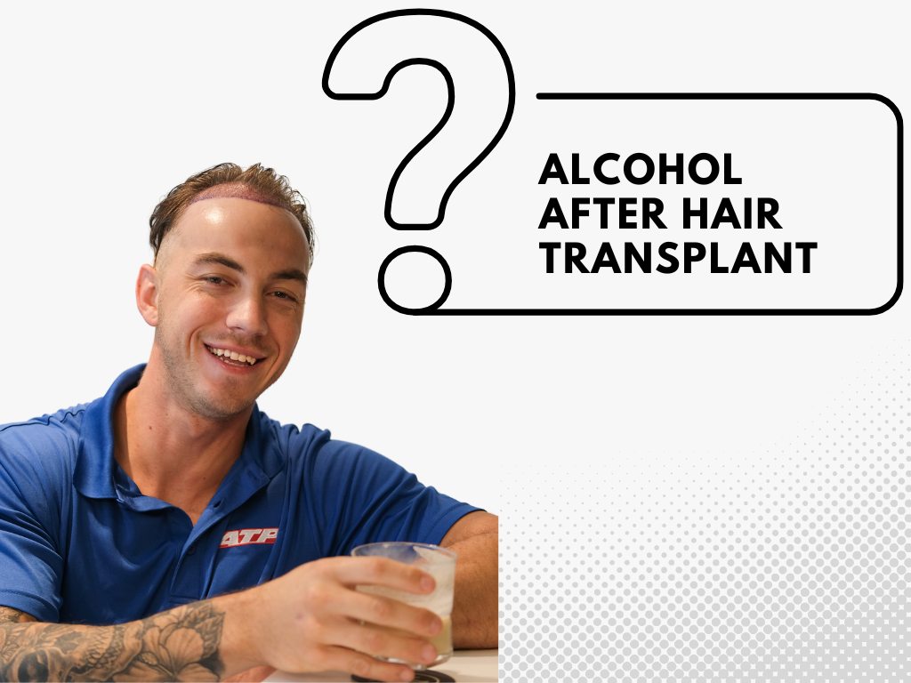 alcohol consumption after hair transplant alcohol consumption after hair transplant