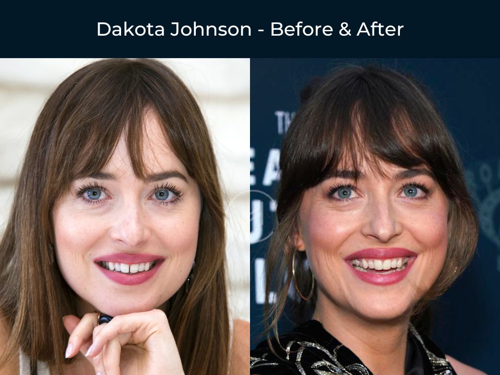 dakota-johnson-tooth-gap-before-after dakota johnson tooth gap before after