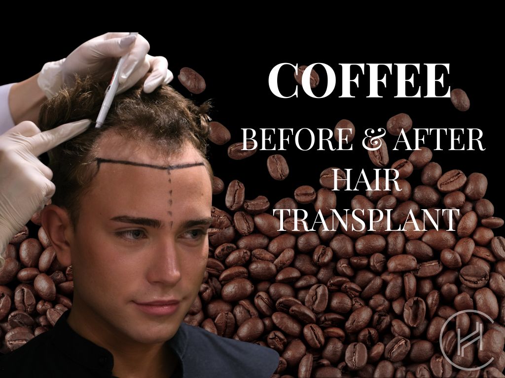 drinking coffee before and after hair transplant