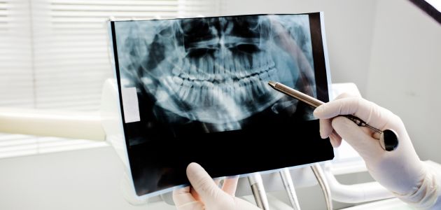 root canal treatment banner