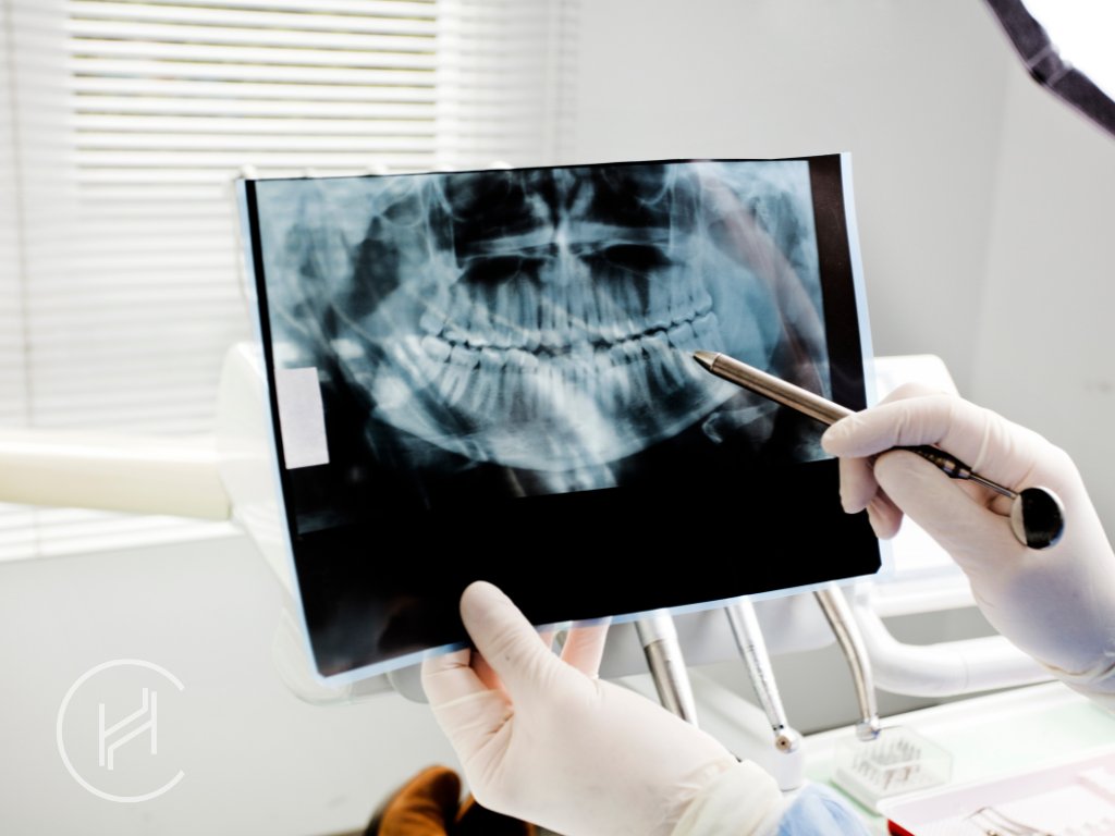 root canal treatment eligibility root canal treatment eligibility