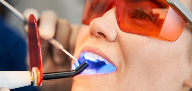 teeth filling process banner