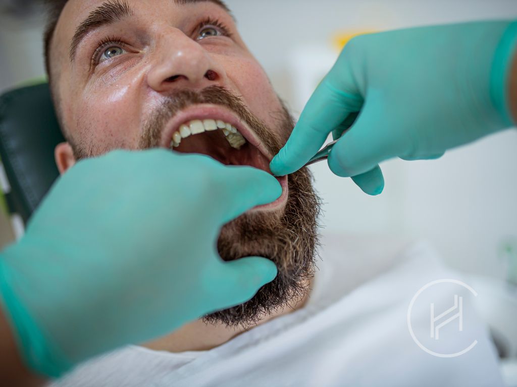tooth extraction process at heva clinic istanbul turkey