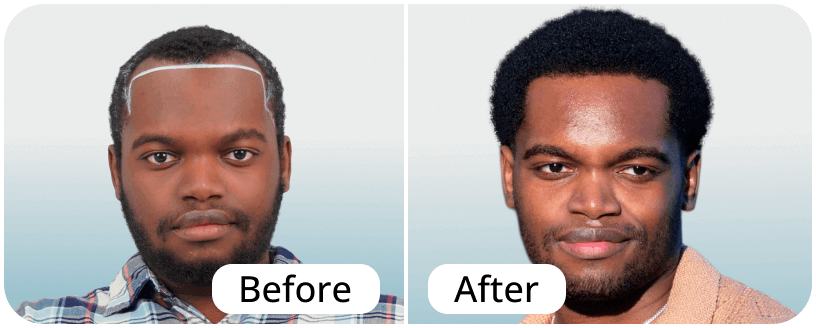 Before-After-1