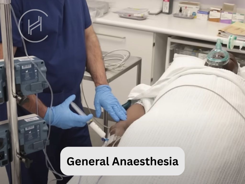 General Anaesthesia for Hair Transplant