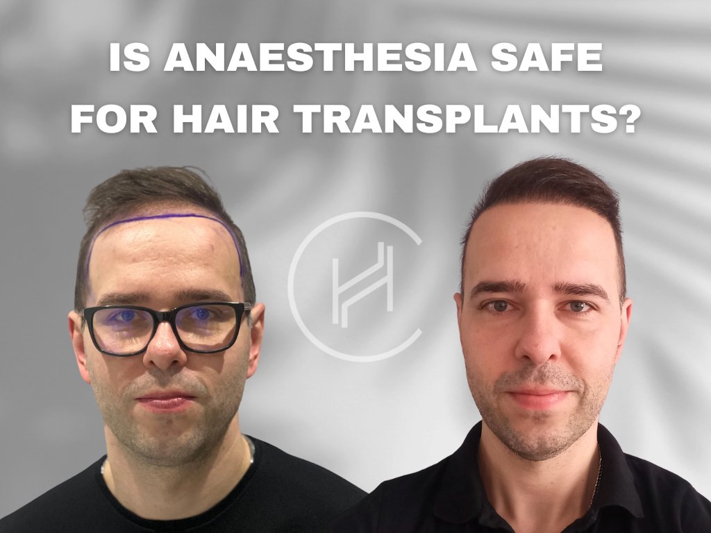 Is Anaesthesia Safe for Hair Transplants Is Anaesthesia Safe for Hair Transplants