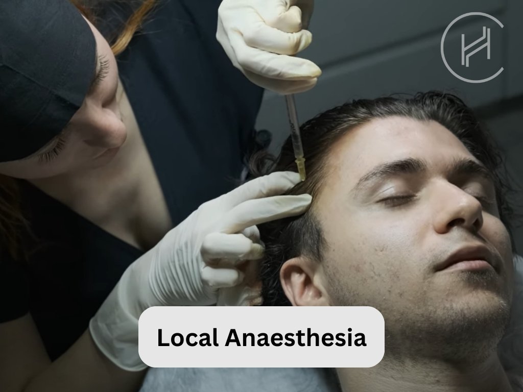 Local Anaesthesia for Hair Transplant