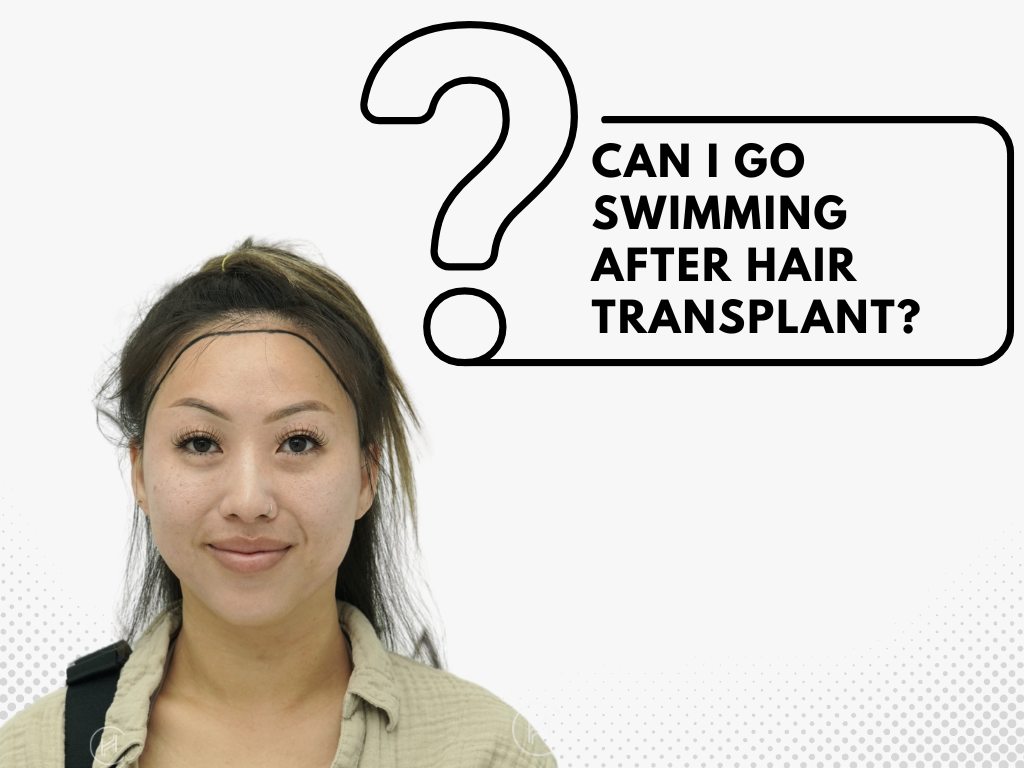 Can I Go Swimming After Hair Transplant Can I Go Swimming After Hair Transplant