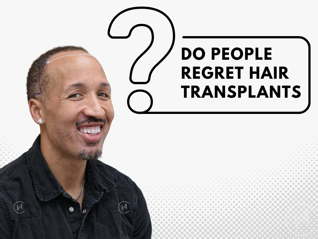Do People Regret Hair Transplants