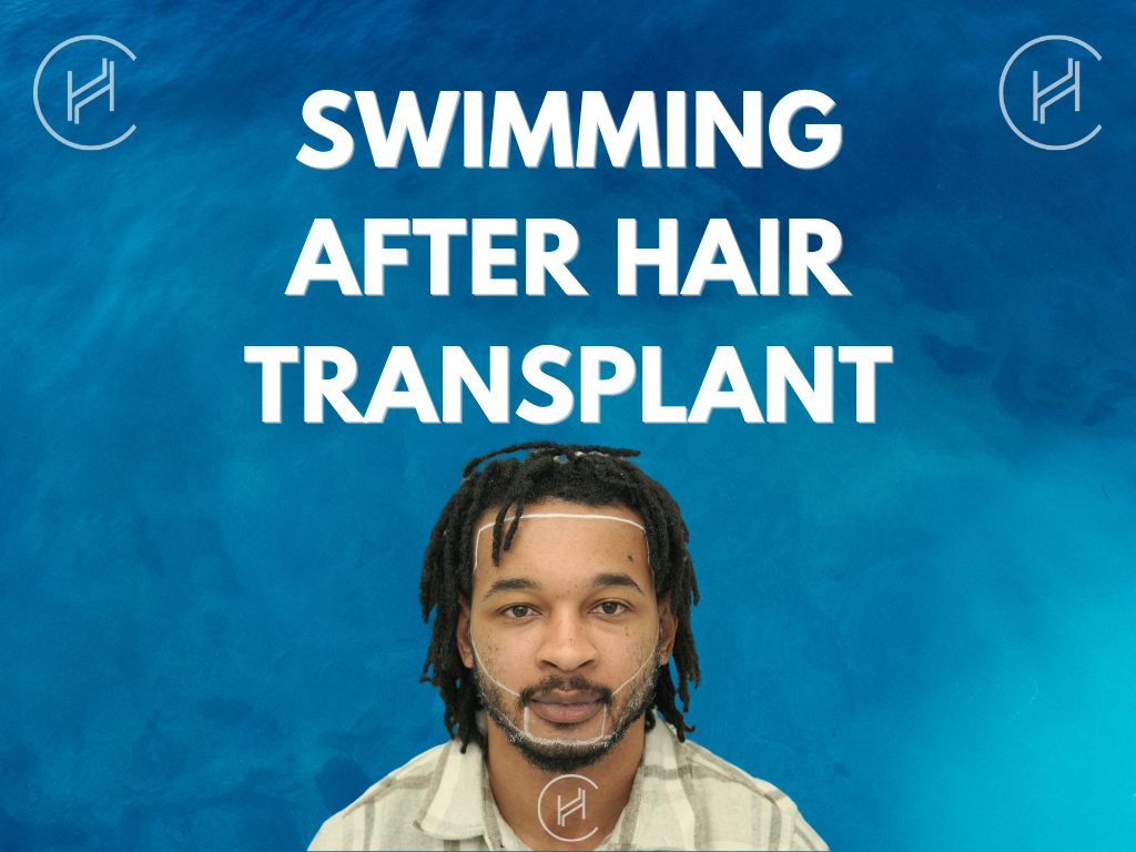 Swimming After Hair Transplant Swimming After Hair Transplant Banner