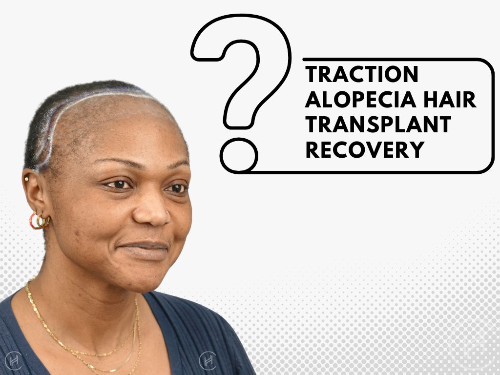 Traction Alopecia Hair Transplant Recovery Timeline Traction Alopecia Hair Transplant Recovery Timeline