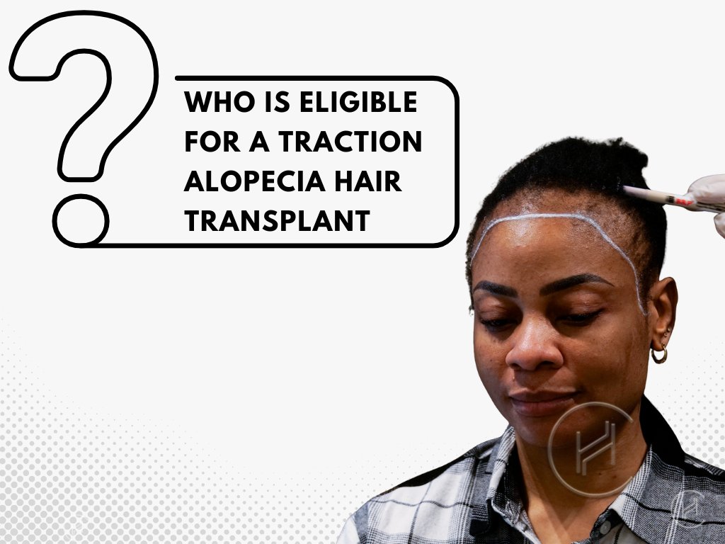 Who is Eligible for Traction Alopecia Hair Transplant Who is Eligible for Traction Alopecia Hair Transplant